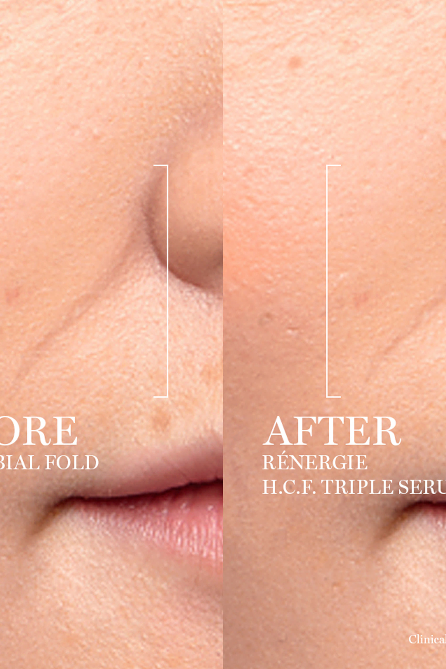 سيروم مركز رينرجي اتش سي اف ثلاثي