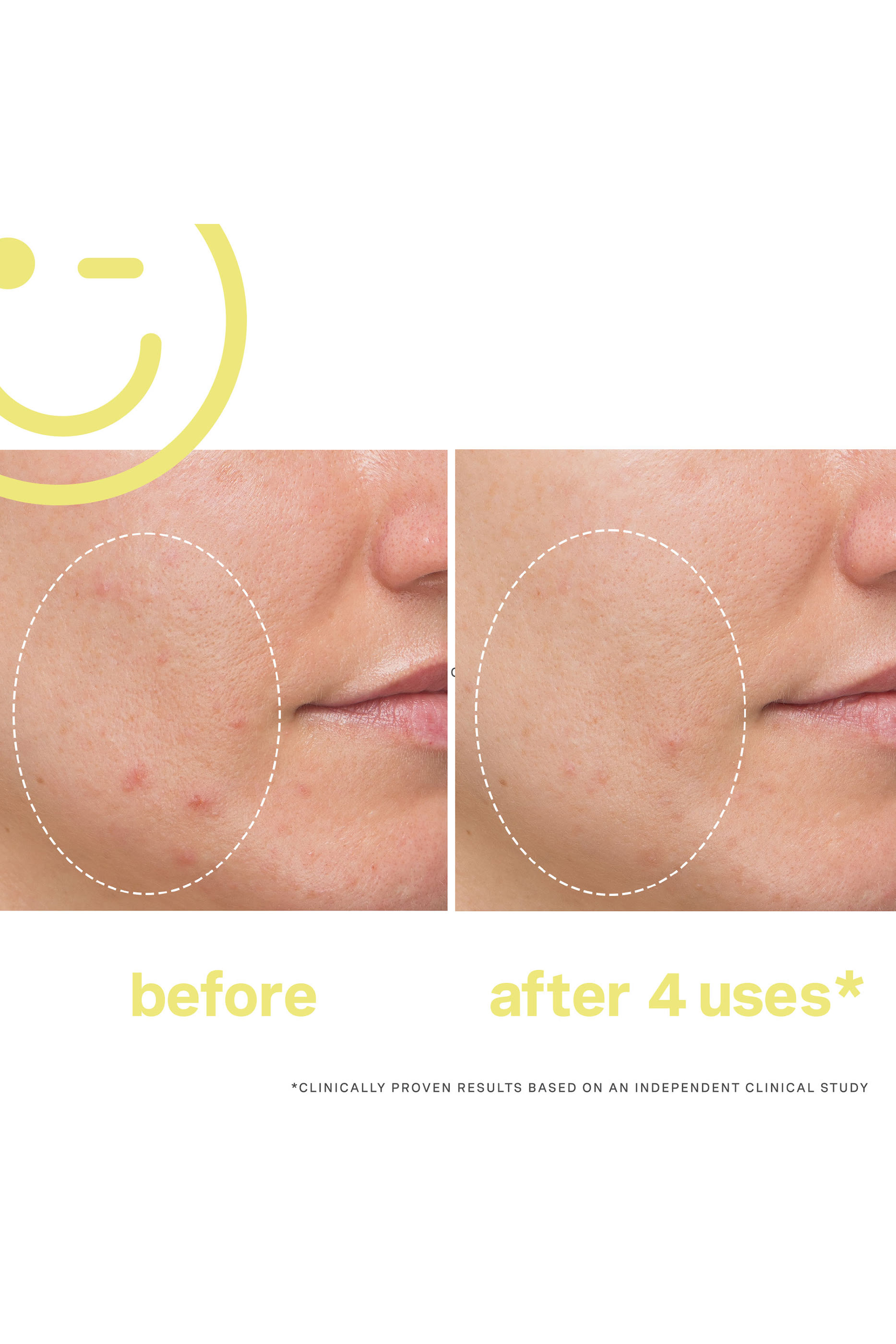 قناع فيشل ميغا-سي&trade; بفيتامين سي 30% لتفتيح البشرة