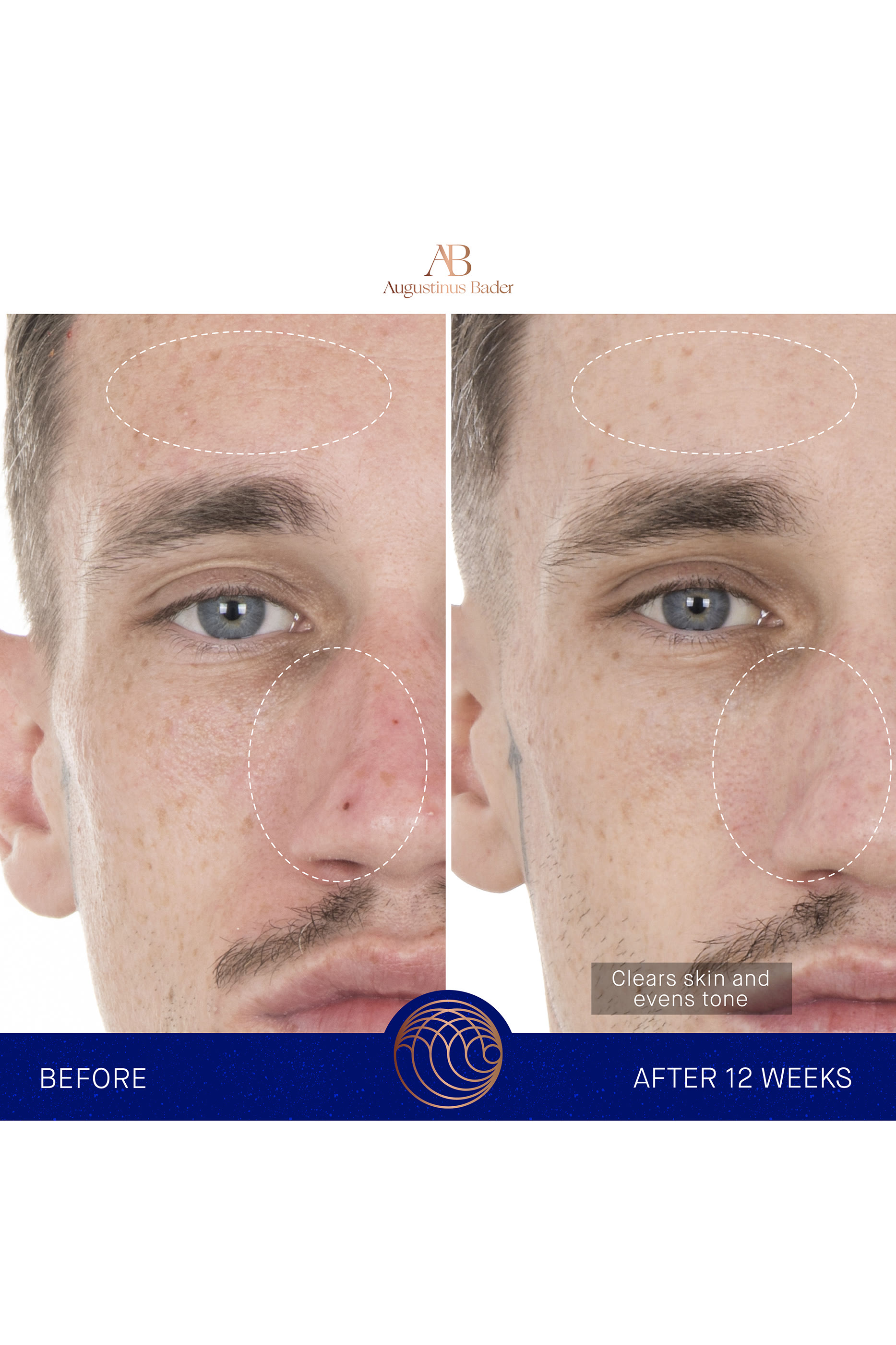 سيروم ريتينول 