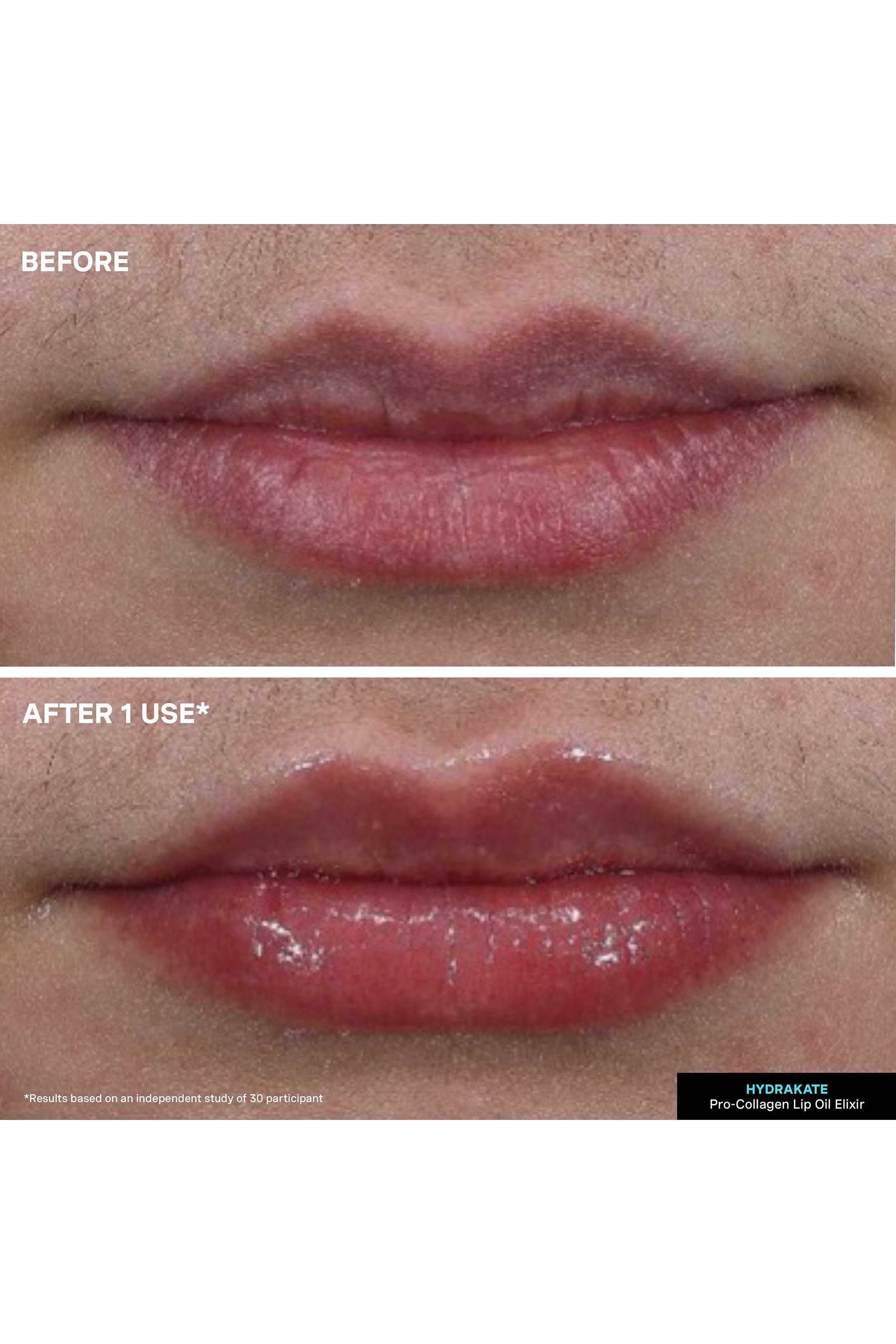 زيت الشفاه برو كولاجين