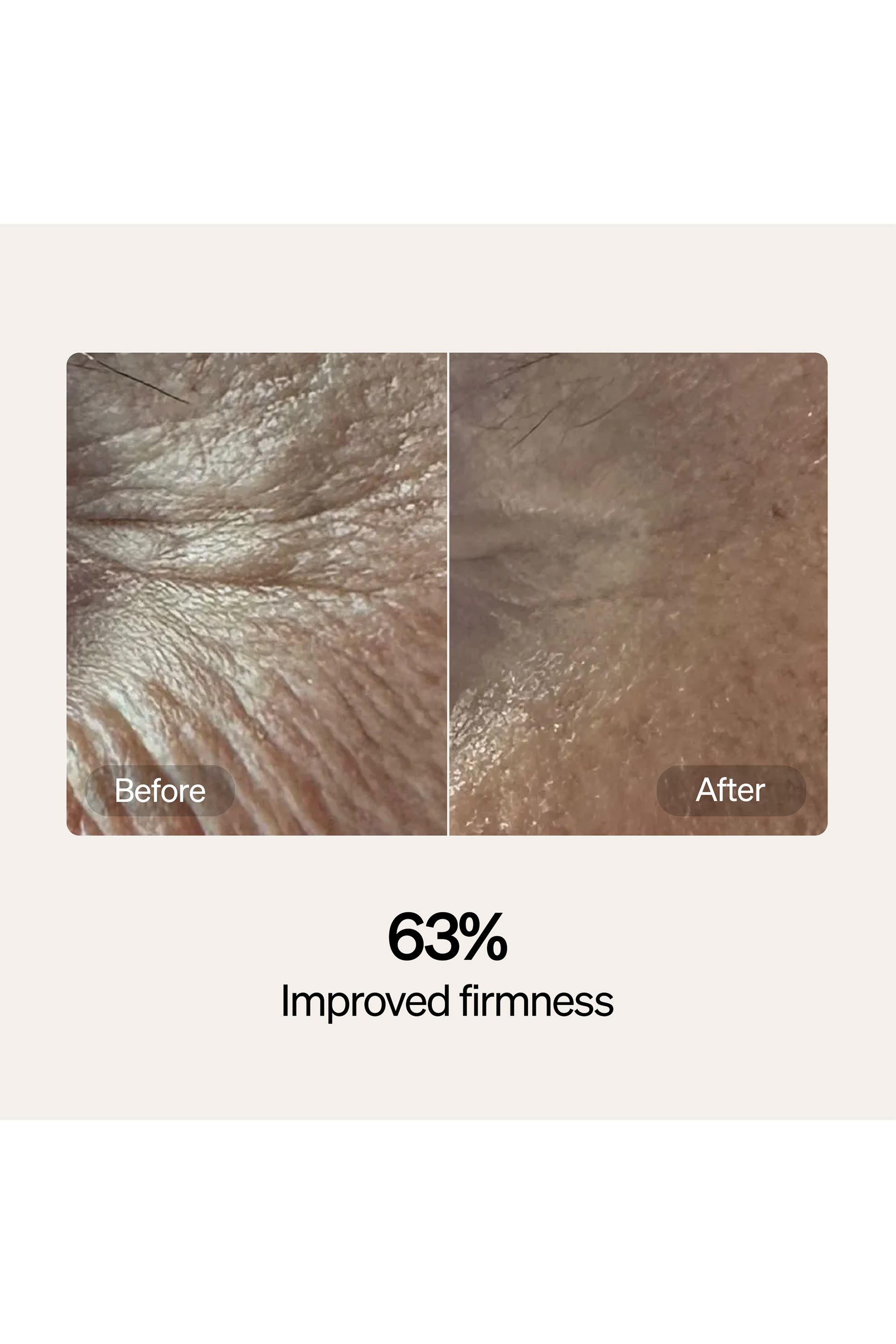 مجموعة بتقنية الليزر للمبتدئين