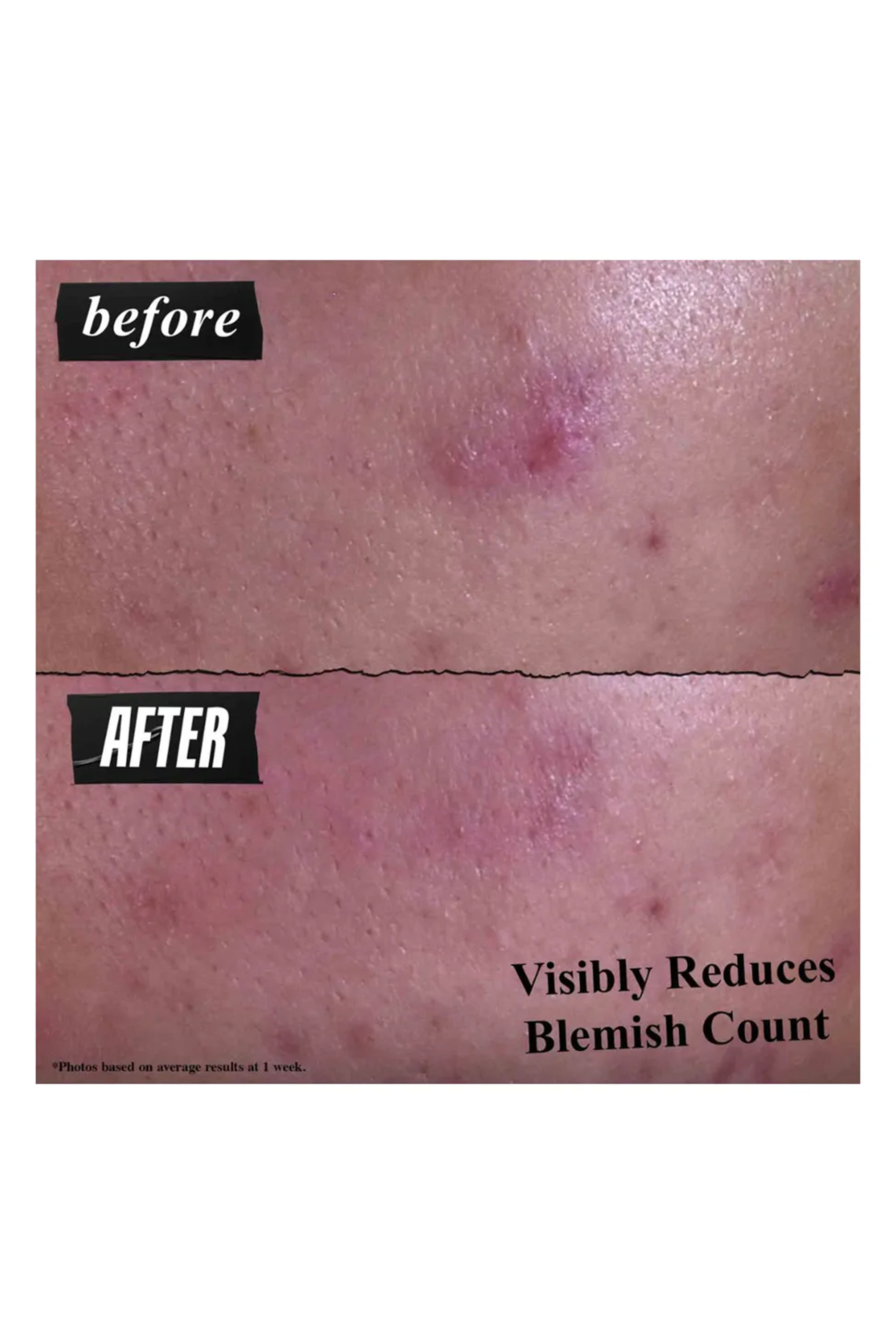 معجون منظف جنتلي إفكتيف لاستهداف العيوب