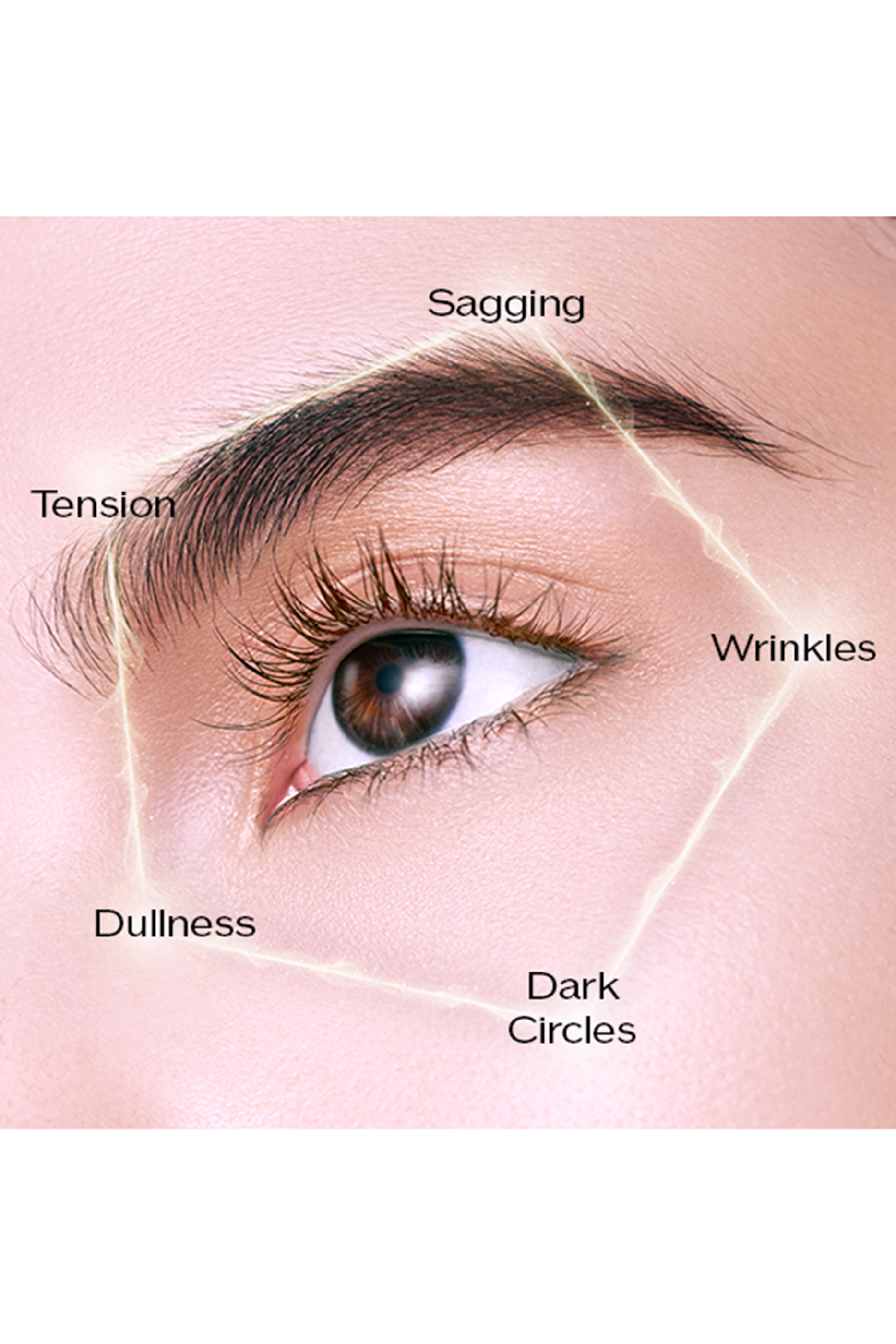 كريم لجندري انمي ألتميت بريلينس للمنطقة المحيطة بالعين