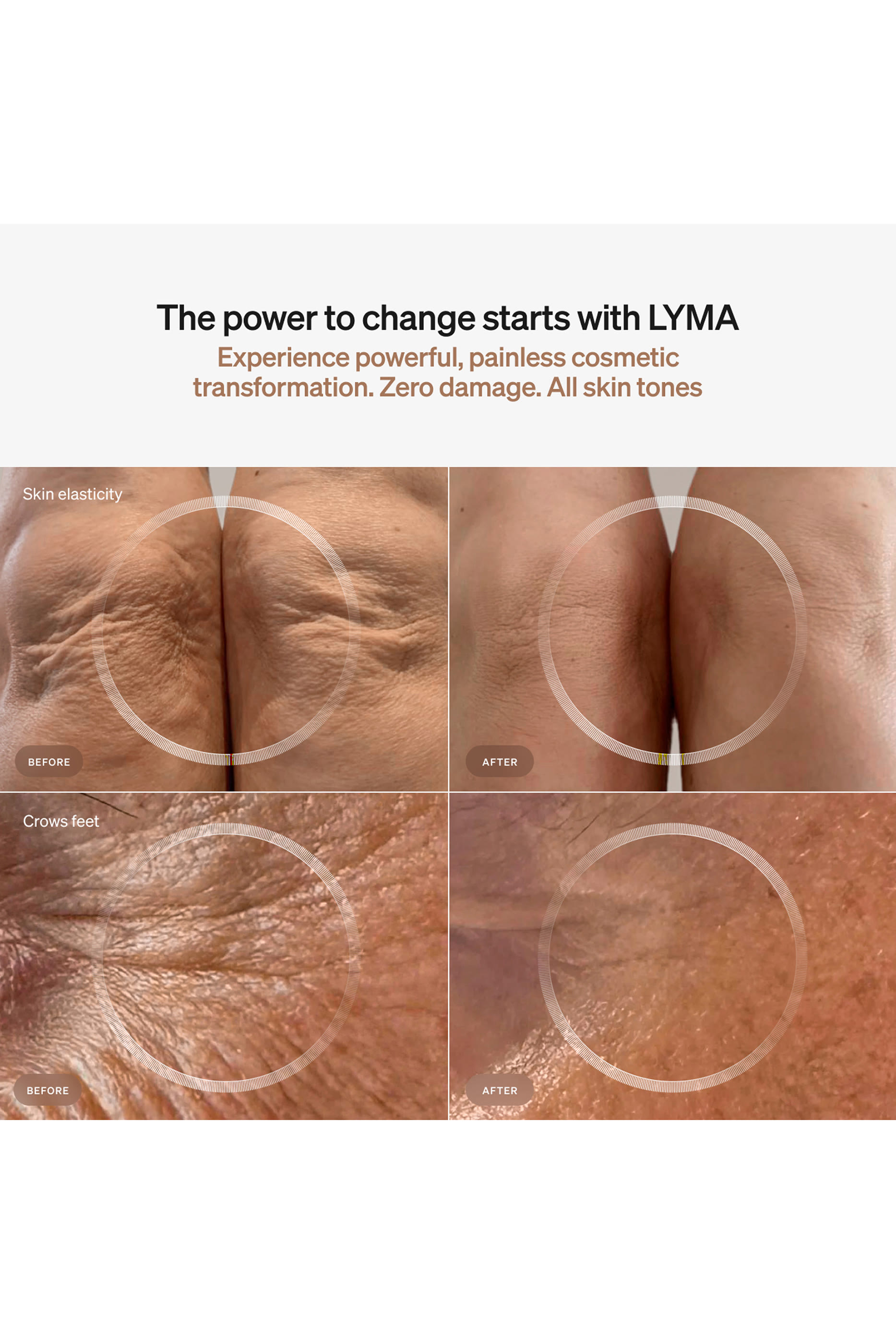 مجموعة بتقنية الليزر للمبتدئين