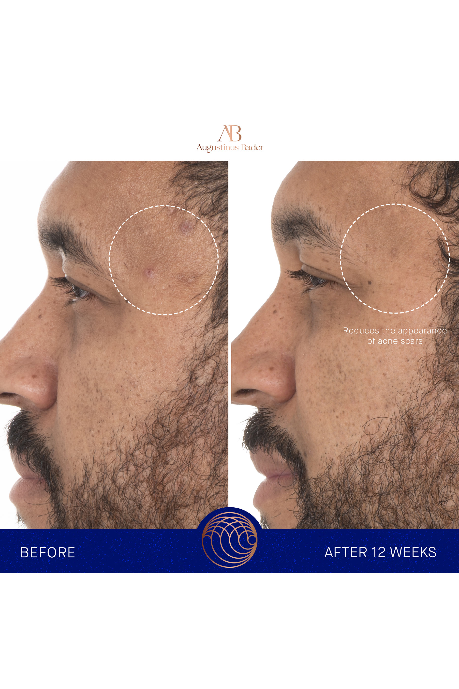 سيروم ريتينول 