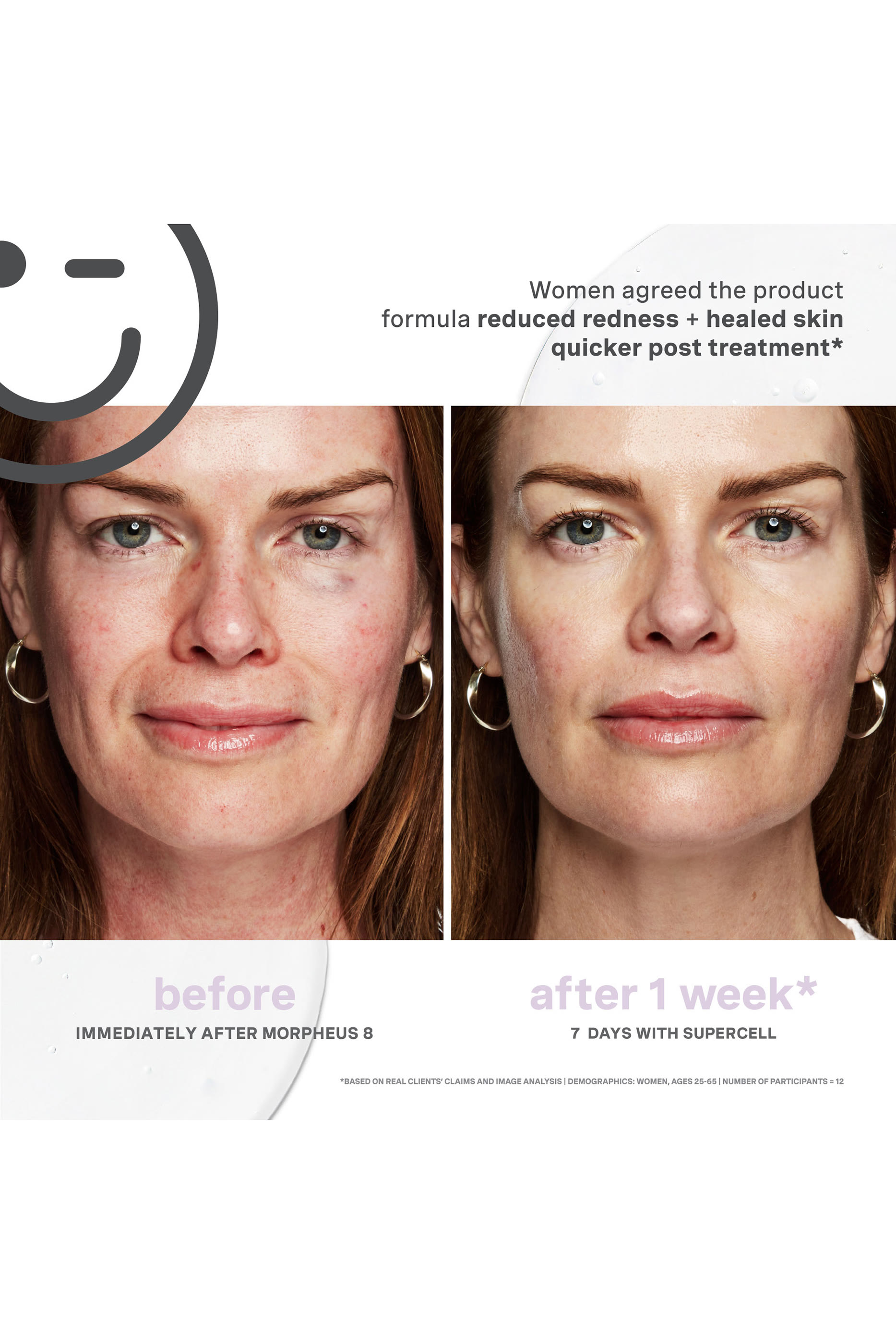 سيروم كيتسيوتيكالز سوبرسيل لتجديد البشرة